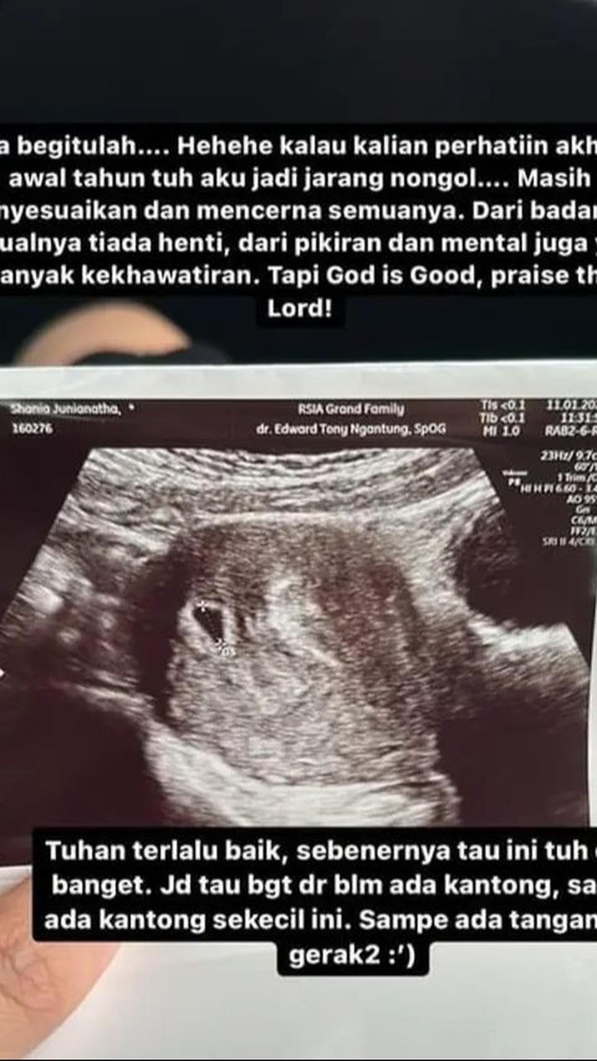 Shanju turut membagikan momen hasil pemeriksaan USG, menambah sentuhan haru.