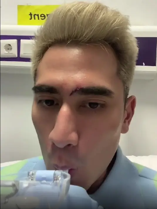 Verrell Bramasta saat menjalani proses jahitan karena alisnya robek akibat terbentur sangat keras. (Instagram @bramastavrl) - 2