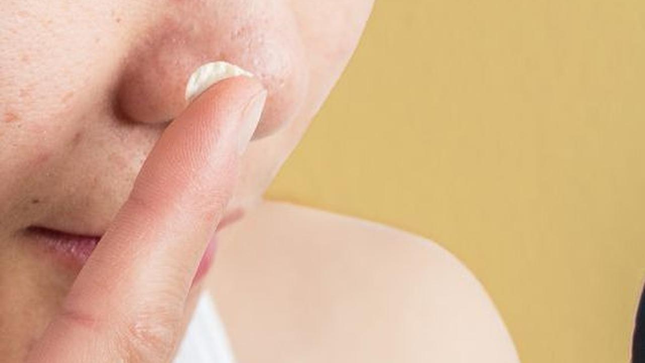 Saran Penggunaan Masker Komedo dari Baking Soda
