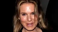 Kurus, Renee Zellwenger Tak Dikenali