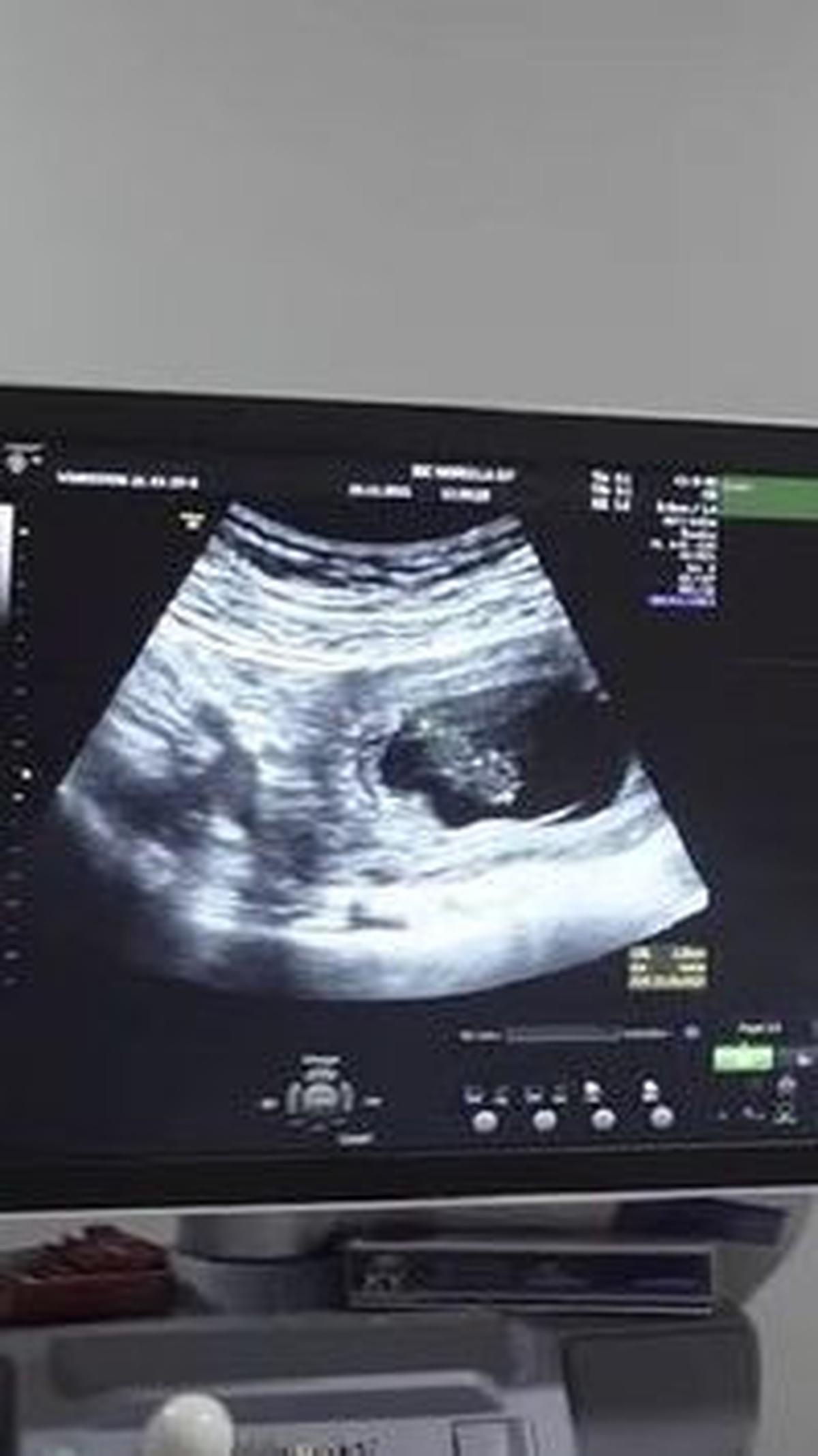 Melakukan Inseminasi
