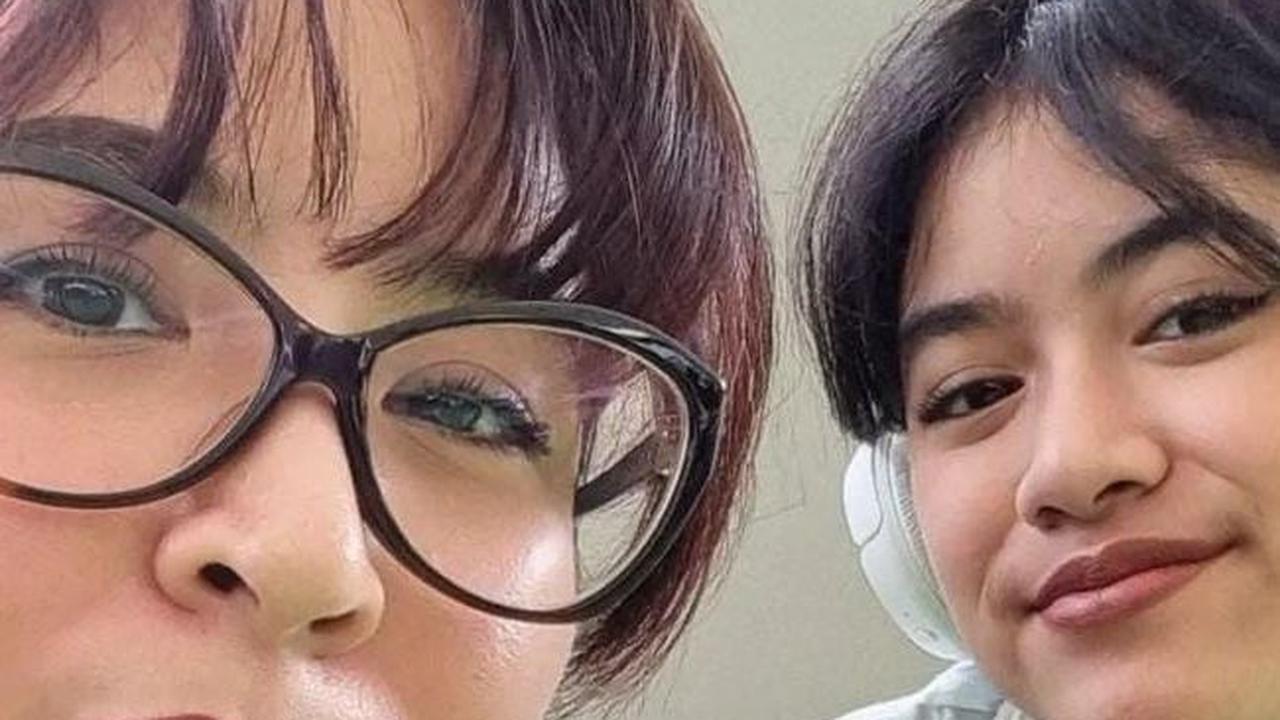 Putri Cantik Novita Angie Jatuh di Eskalator dan Dilarikan ke RS, Begini Kondisinya