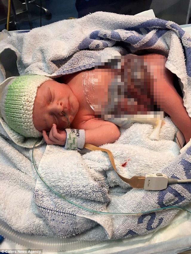 Maisie sesaat setelah lahir | Photo: Copyright dailymail.co.uk