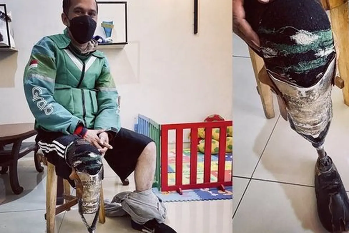 Ojol pakai kaki palsu