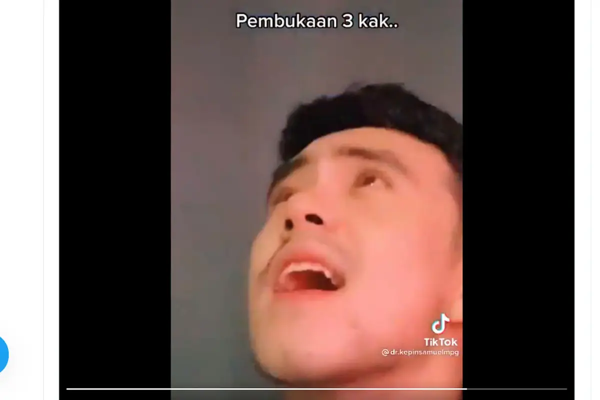 Dokter Kevin Samuel Marpaung, Dokter Kevin Samuel, Persalinan, Video TikTok, Dr Kevin Samuel