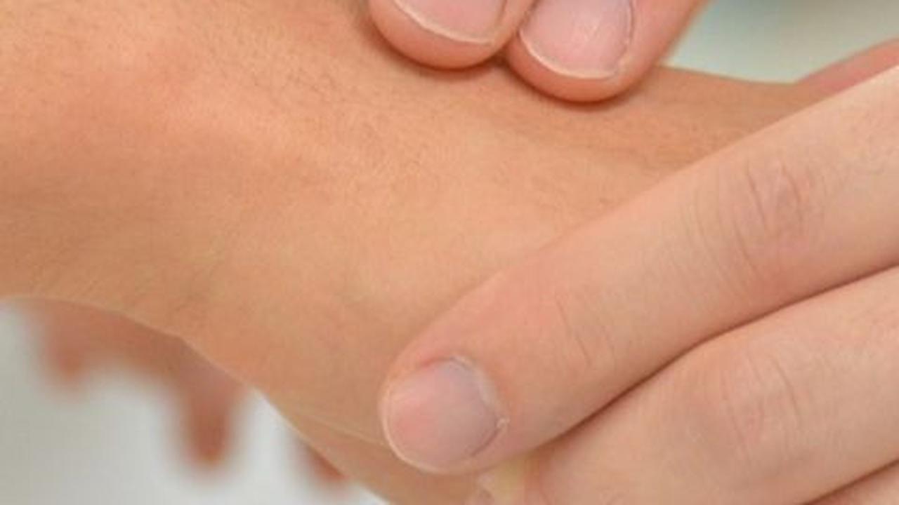Cara Mencegah Herpes Zoster, Vaksinasi hingga Terapkan Kebiasaan Bersih