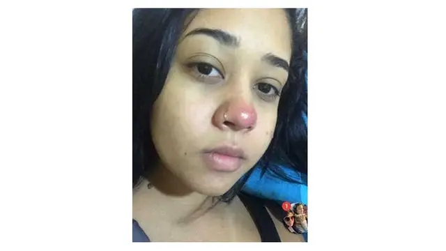 tindik hidung malah lumpuh