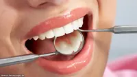Gusi Bengkak, Gigi Keropos Waspadai Virus Penyerang Organ Vital!