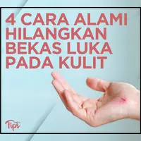 4 Cara Alami dan Ampuh untuk Hilangkan Bekas Luka pada Kulit