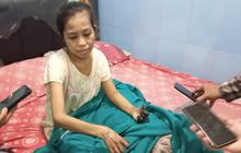 Nestapa TKI Jember Diduga Korban Malapraktik RS di Singapura: Operasi Bisul Malah Koma, Kaki Tangannya Gosong