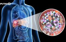 IDAI Ungkap 10 Anak Sudah Kena Hepatitis B di Sumut, Khawatir seperti Gunung Es