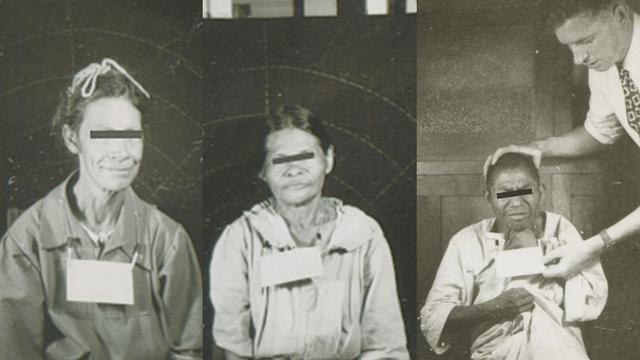 Ngeri, 5 Eksperimen Ini Gunakan Manusia Sebagai Kelinci Percobaan