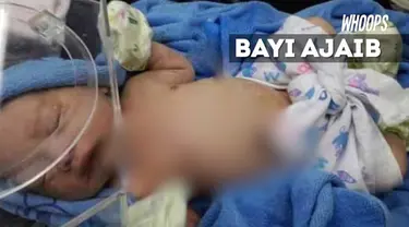 Dokter takjub melihat kondisi luka sang bayi yang cepat pulih.