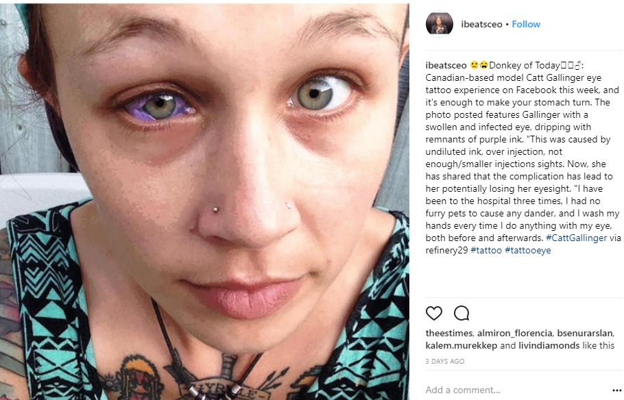 Kenali Bahaya Sclera Tattoo Tato  Bola Mata  yang 