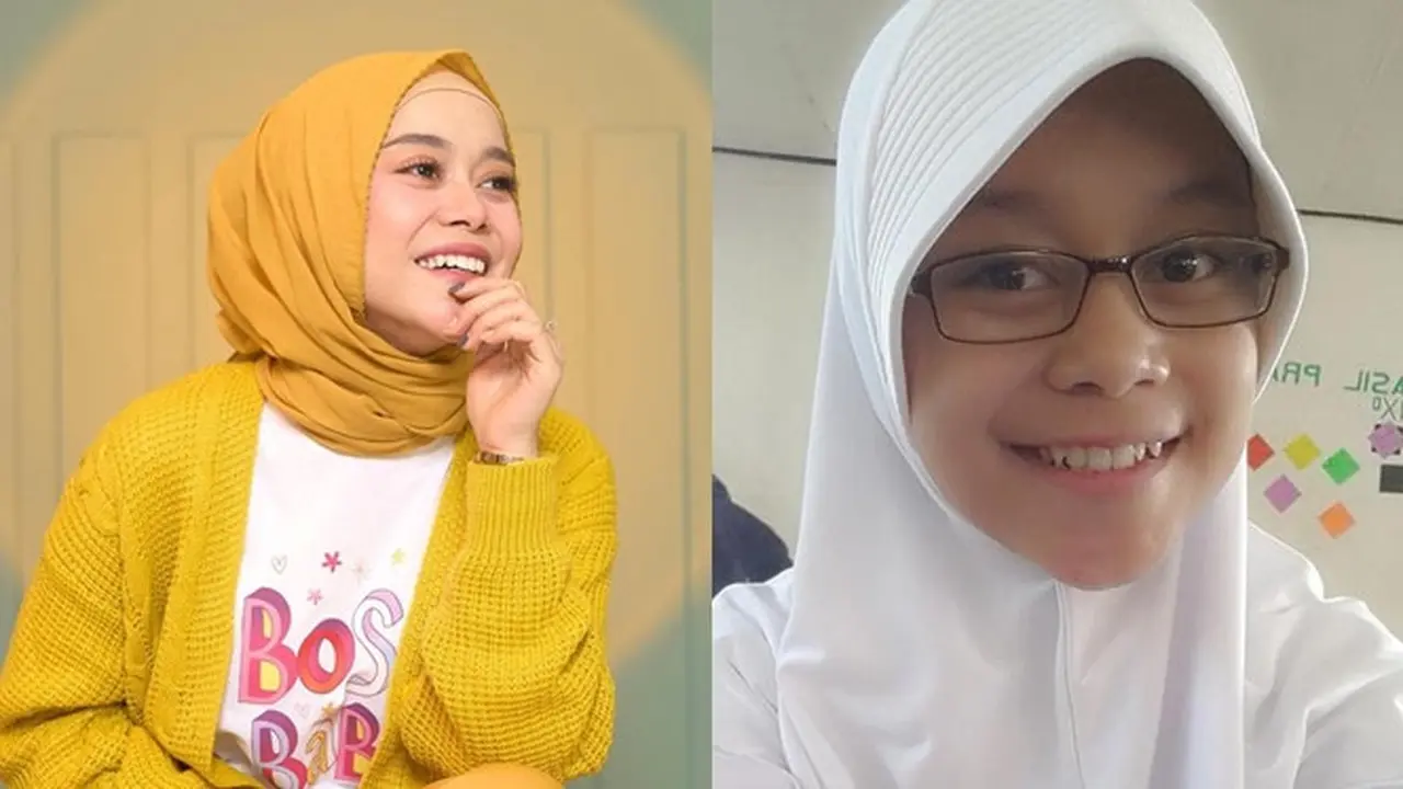6 Foto Masa Remaja Lesty Kejora saat Pakai Kacamata Ini Bikin Pangling