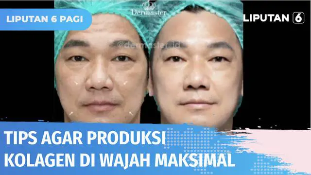 Banyak sebab bisa membuat produksi kolagen pada wajah tidak maksimal sehingga timbul banyak masalah kulit. Seperti terpaan sinar matahari, merokok, dan kurang tidur. Apa solusinya agar tetap percaya diri dengan wajah lebih glowing? Ikuti tips ini yuk...