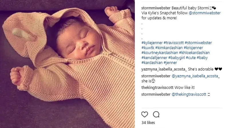 Bibir Seksi Stormi Webster, Calon Model Kylie Cosmetics?