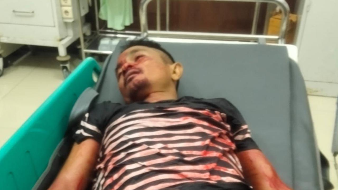 Ricuh di Tempat Karaoke saat Ramadan, Polisi Tewas Ditikam Preman