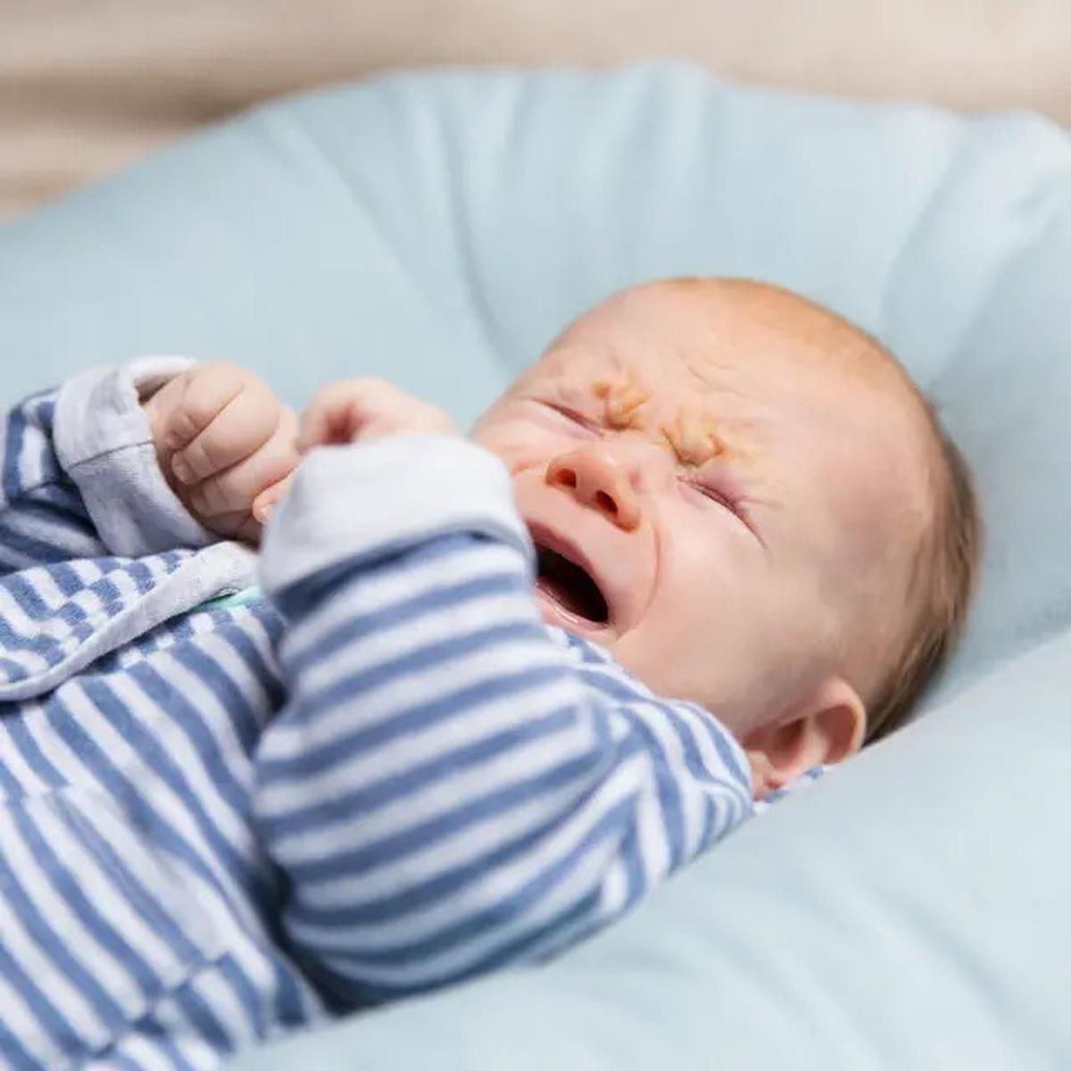 7 Tanda Alergi pada Bayi dan Cara Efektif Mengatasinya, Jangan Sampai Terabaikan!