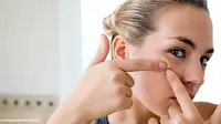 Acne Diet, Tubuh Langsing Jerawat pun Hilang