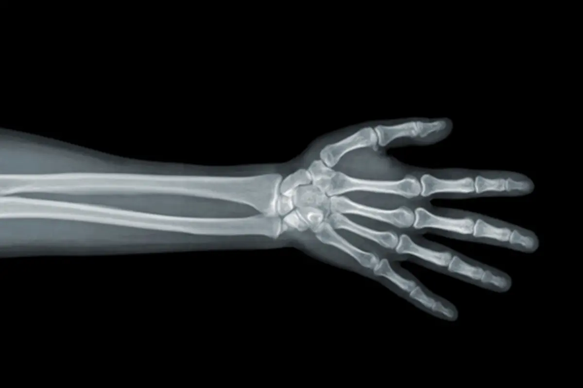 Copyright by Thinkstock.com