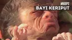 Seorang bayi di Bangladesh lahir dengan kondisi yang sangat langka. Bayi ini lahir dengan wajah keriput sehingga seperti kakek-kakek