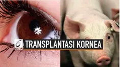 Seorang wanita China bernama Huang Yuanzhen menjadi orang pertama yang menerima transplatasi kornea dari babi. KIni pemglihatannya mulai membaik.