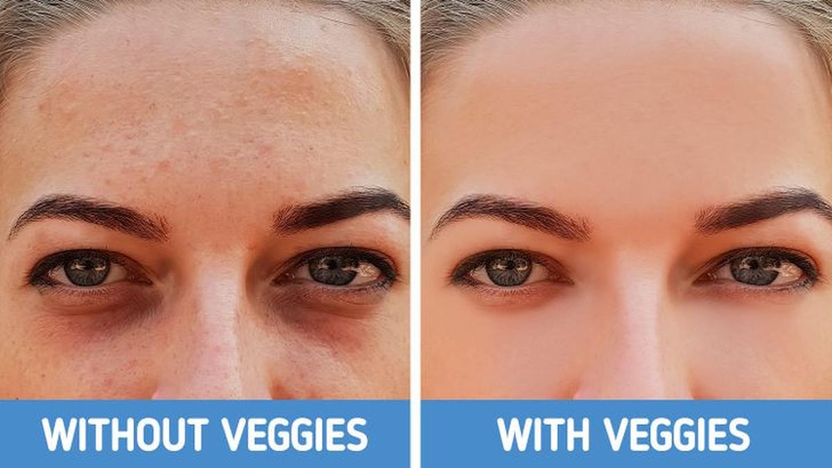 Kenali 4 Jenis Lingkaran Hitam di Bawah Mata dan Cara Tepat Mengatasinya