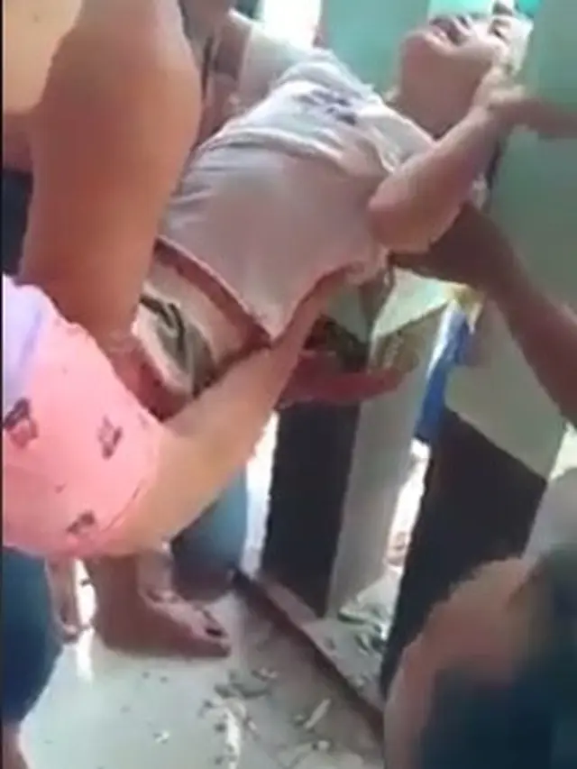 kepala bocah tersangkut di tembok