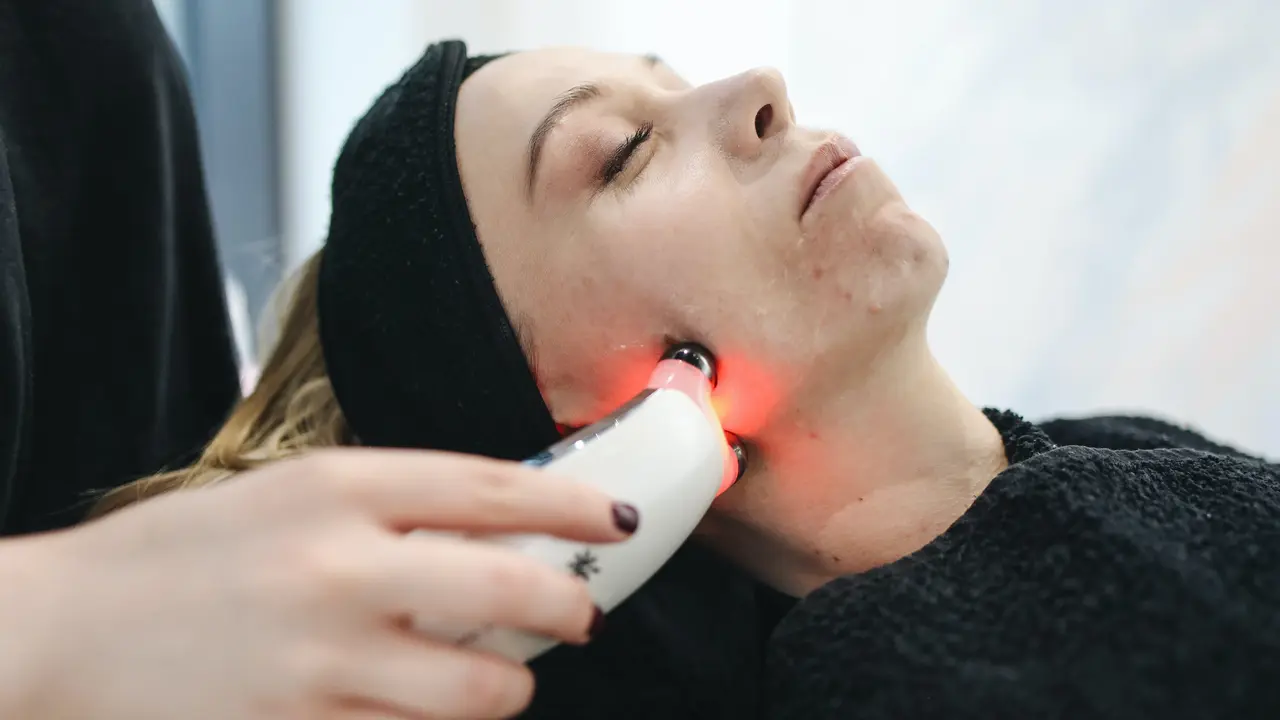 6 Tips Perawatan Wajah Setelah Melakukan Chemical Peeling