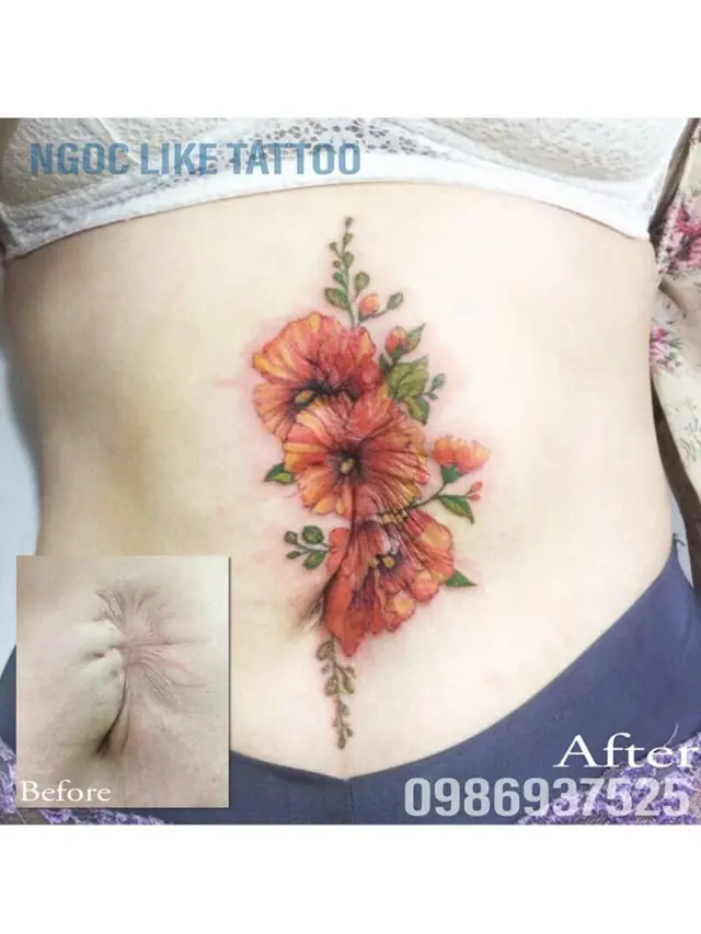 7 Potret Tato Keren Sulap Bekas Luka Jadi Seni Indah