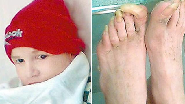 7 Anak (Malang) yang Dibesarkan Binatang