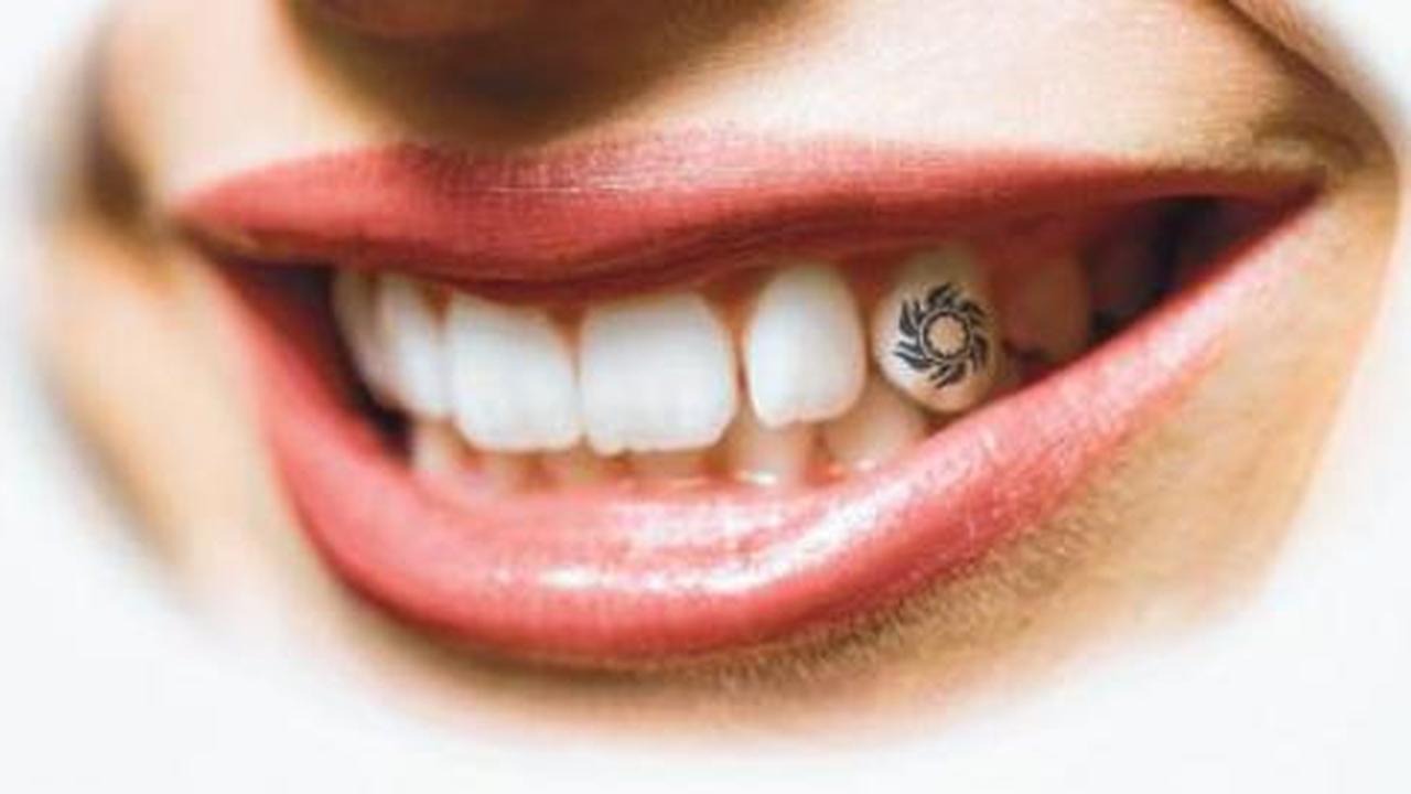 Bosan dengan tato tubuh? Anda bisa coba tato gigi!
