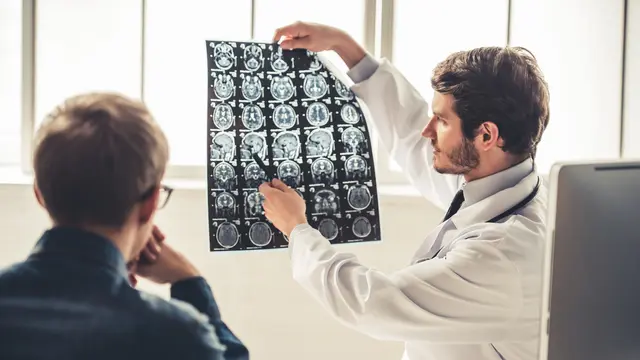 Ilustrasi stroke (iStockphoto)