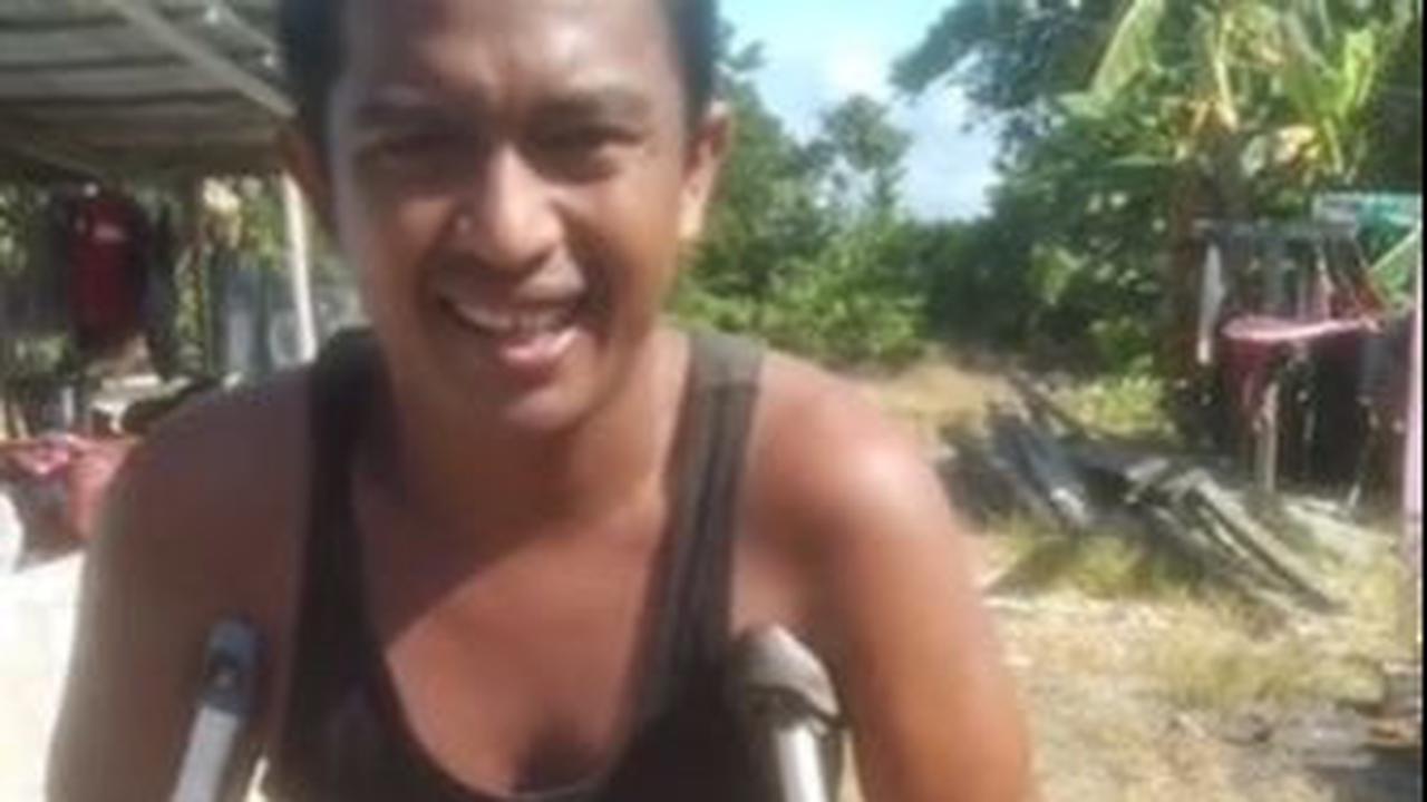 Kemudian kakinya semakin mengecil dan melemah sampai akhirnya lumpuh secara perlahan.