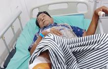 Tubuh Petani Ini Penuh Luka Akibat Digigit dan Dicakar Beruang saat Menyadap Karet, Selamat Usai Menyabetkan Golok