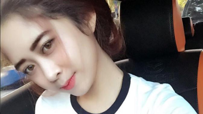 Ini Wanita  Cantik Asal Bandung  yang Disiram Air Keras 
