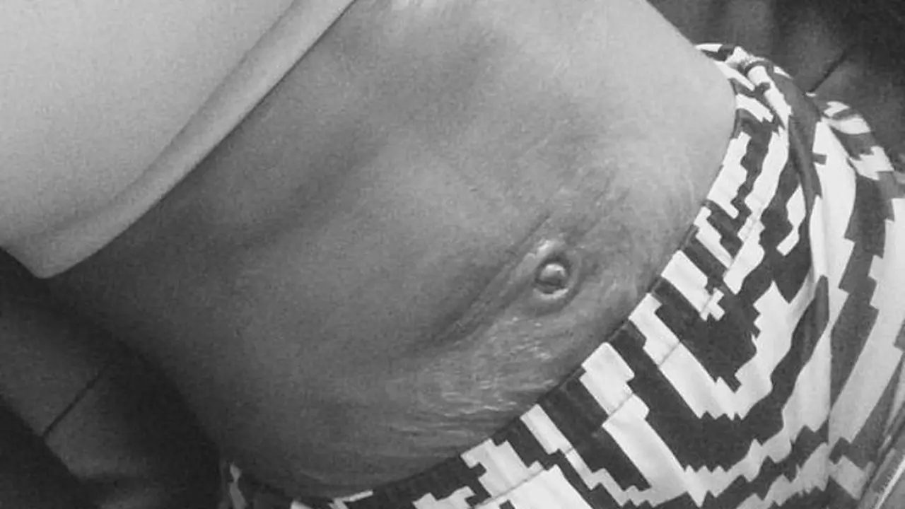 [Bintang] Ketika Stretch Marks Jadi Kebanggan Lewat Hestek #LoveYourLines