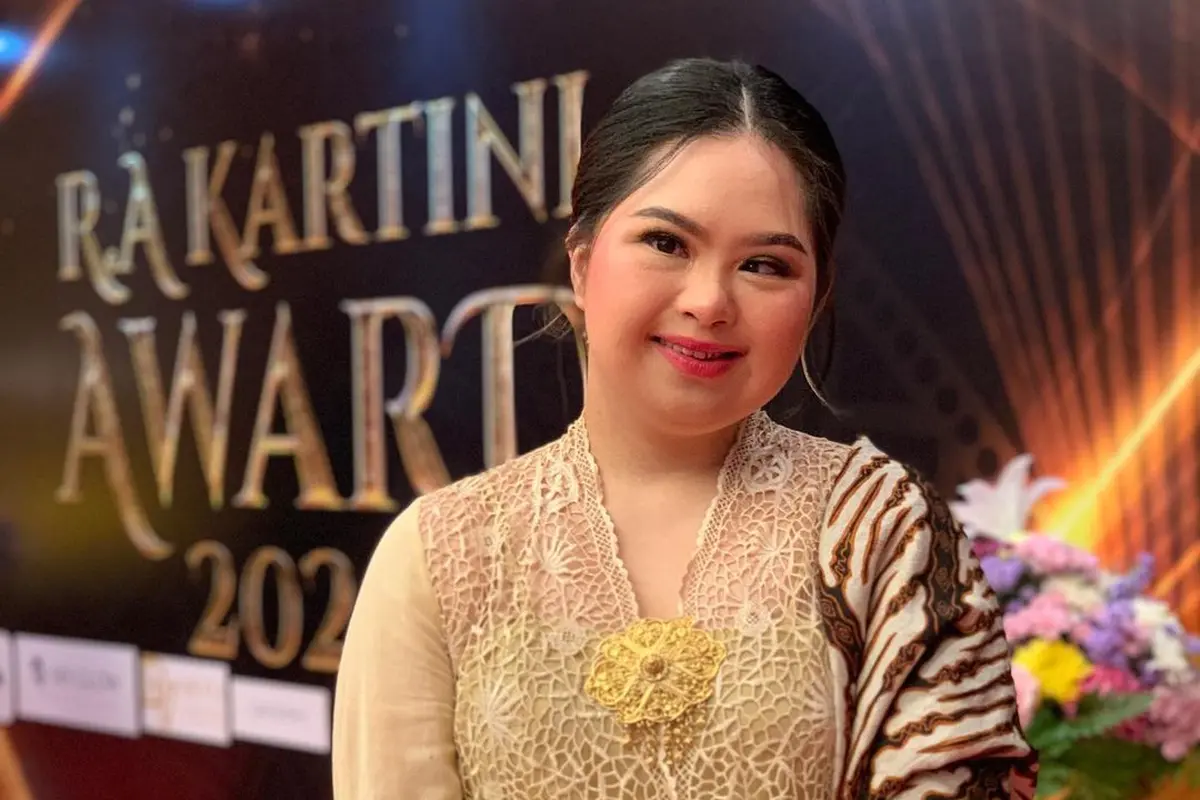 Fimela Figure: Cerita Spesial Namira Zania, Gadis Down Syndrome yang Jadi Penari hingga Model Profesional