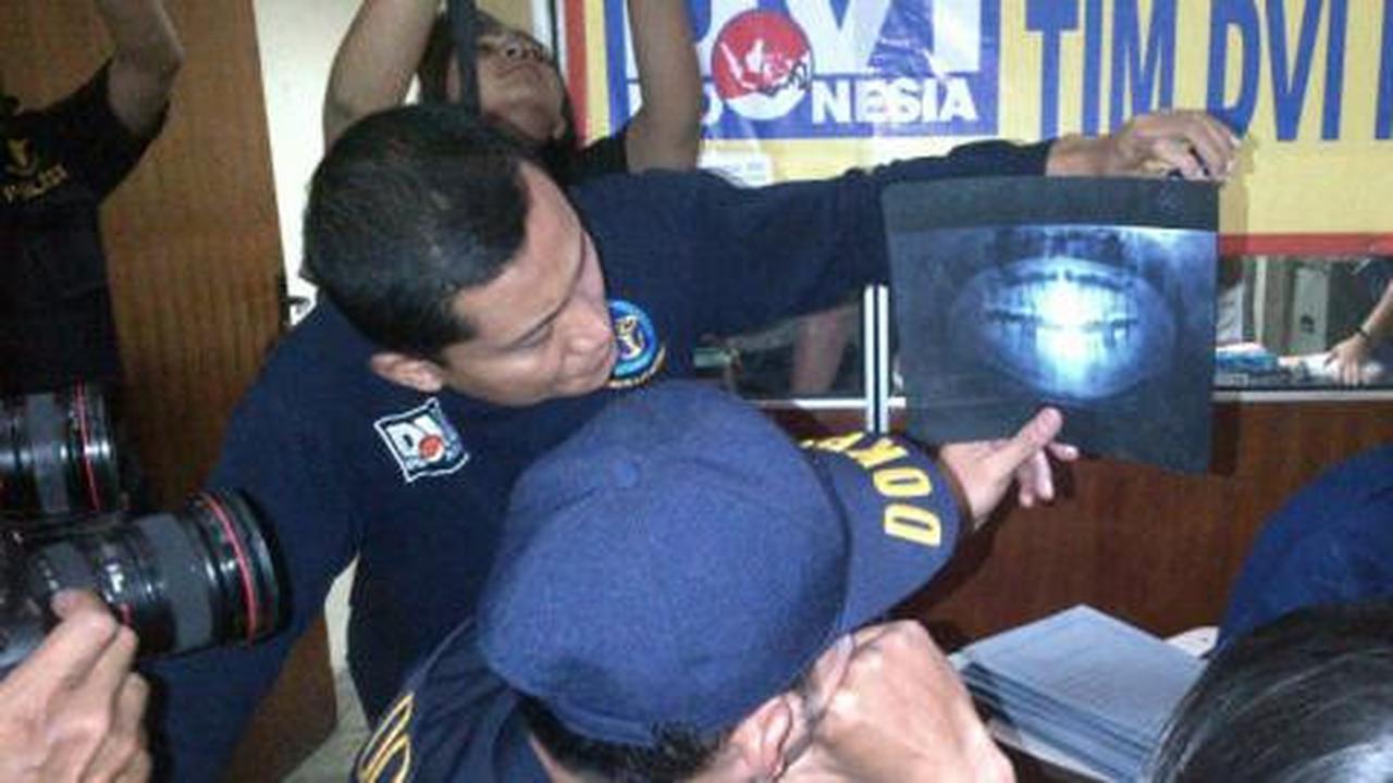 Tim DVI identifikasi sisa potongan tubuh korban Sukhoi
