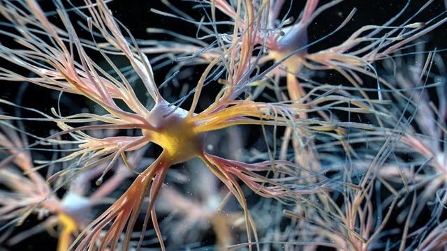 Ganti Sel Otak Lama dengan Baru