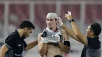 Timnas Filipina Hanya Diperkuat 18 Pemain di Piala AFF 2018