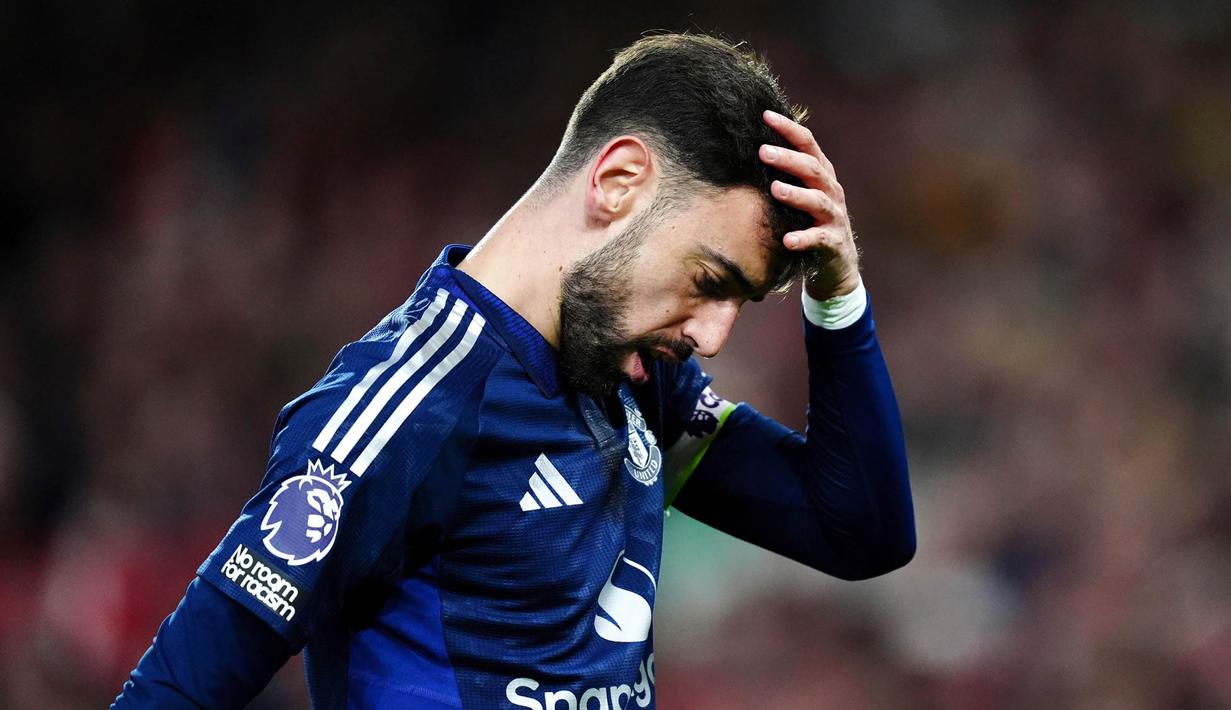 Pemain Manchester United, Bruno Fernandes, tampak kecewa setelah ditaklukkan Nottingham Forest pada lanjutan Liga Inggris di The City Ground pada Selasa (1/4/2025). (Mike Egerton/PA via AP)