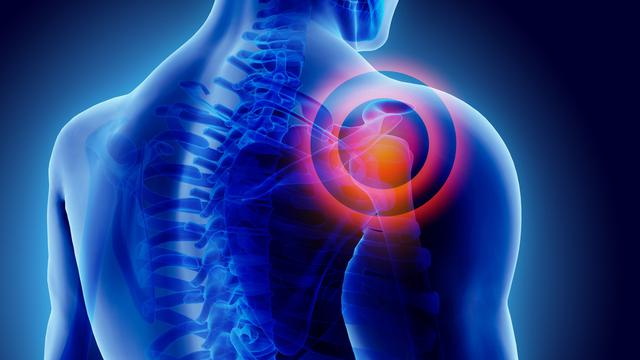 Ingin Sembuhkan Nyeri Bahu, Kenali Penyebab dan Dokter Spesialis yang Menanganinya