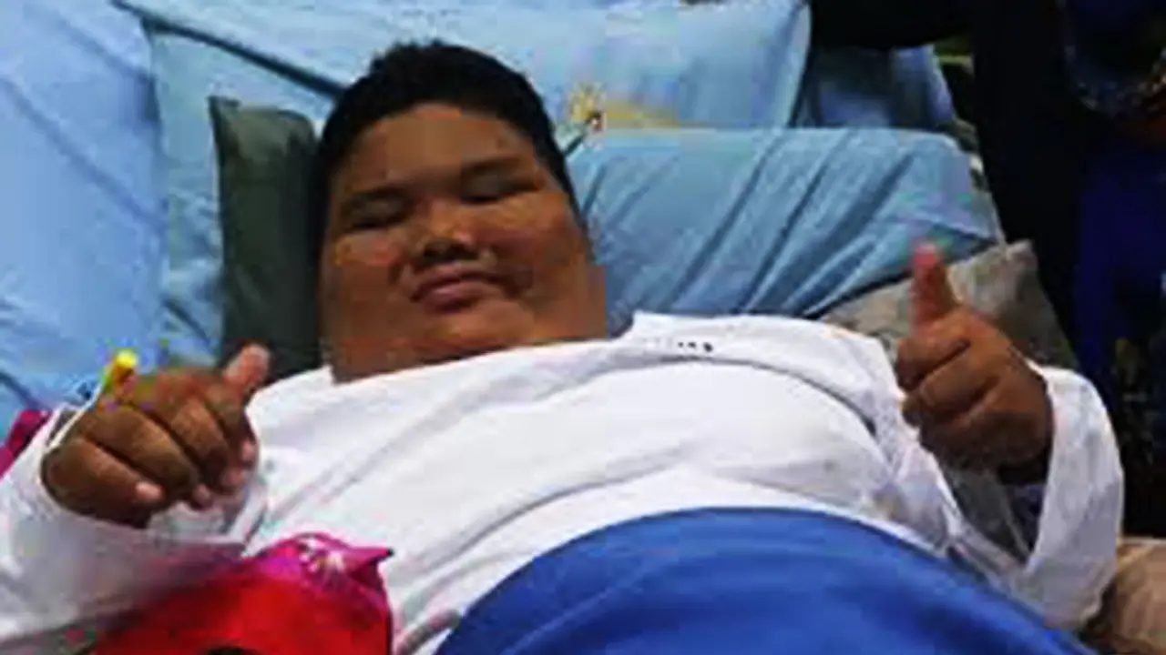 Bocah Obesitas asal Palembang