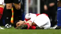 Eduardo da silva mendapat cedera yang paling parah ketika ia membela Arsenal, Peristiwa ini terjadi tahun 2008. Tekel bek Martin Taylor menyebabkan Eduardo Da Silva mengalami patah tulang fibula dan dislokasi pada pergelangan kakinya. (www.skanaa.com)