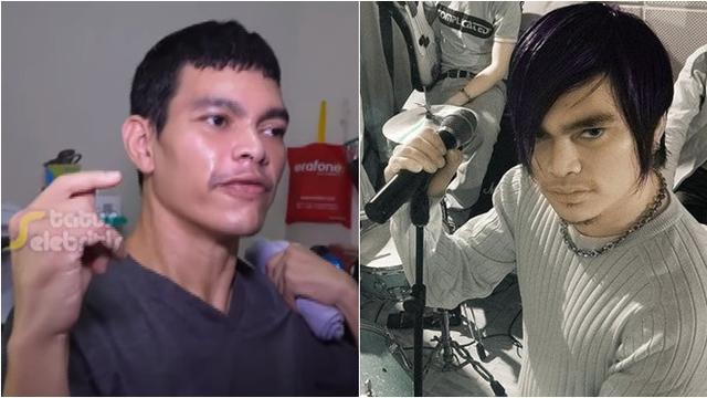 7 Potret Terbaru El Ibnu Vokalis Band Elkasih Yang Stroke Dan