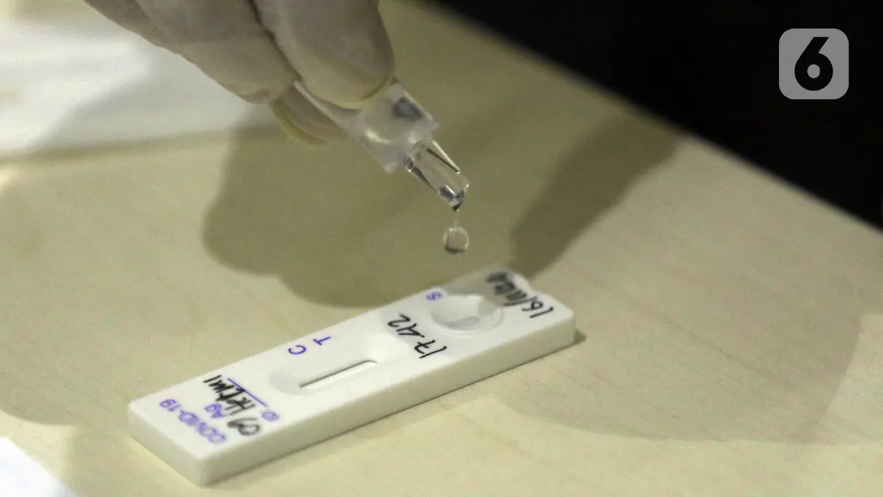FOTO: Cegah Penyebaran COVID-19, Pewarta Jalani Rapid Test Antigen