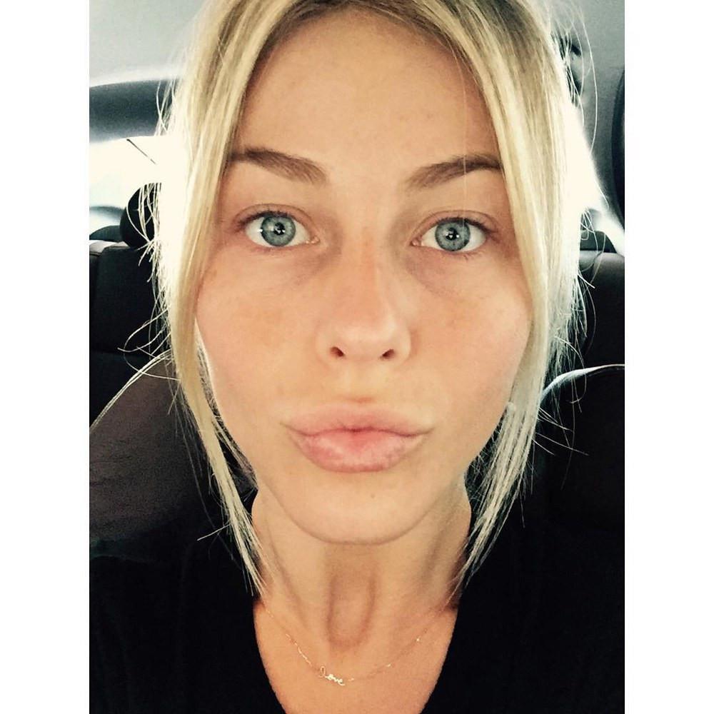 Julianne Hough, salah satu selebritas dunia yang masih berjuang melawan masalah kulit berjerawat. Sumber foto: teenvogue.com.