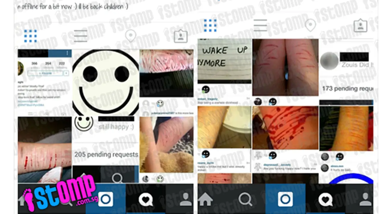 Posting Foto Menyakiti Diri Sendiri, Apakah Tren di Instagram?